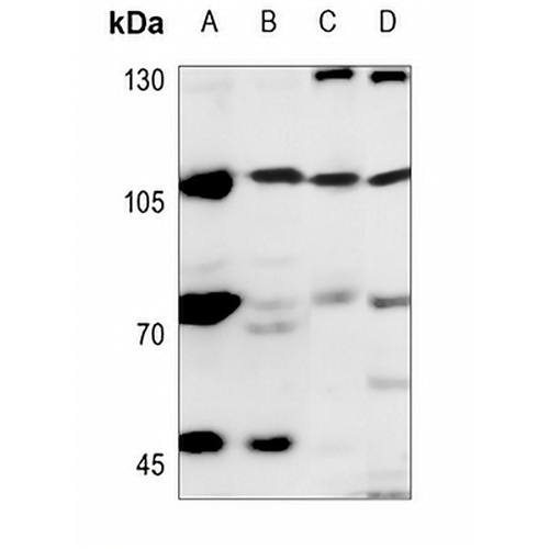EXO1 Rabbit Polyclonal Antibody