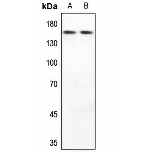 MYOM2 Rabbit Polyclonal Antibody