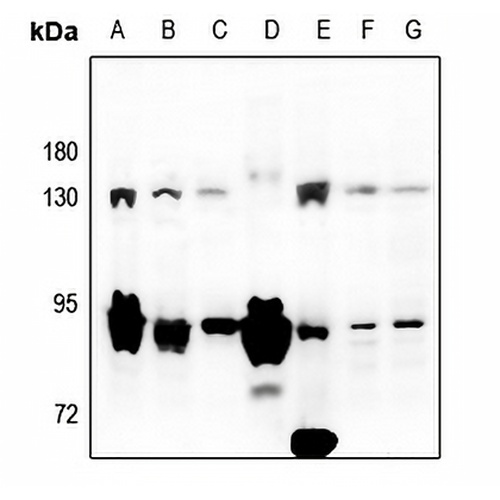 LZK Rabbit Polyclonal Antibody