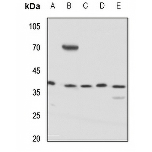 KCNAB3 Rabbit Polyclonal Antibody