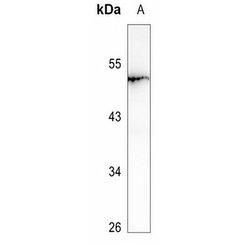 LRAT Rabbit Polyclonal Antibody