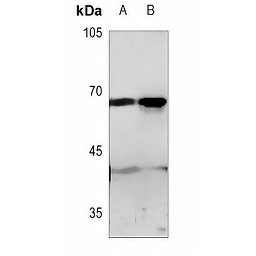 GPR50 Rabbit Polyclonal Antibody