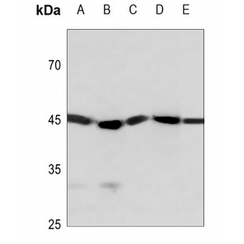 STK17B Rabbit Polyclonal Antibody