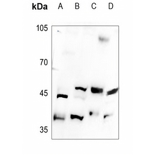 B4GALT5 Rabbit Polyclonal Antibody