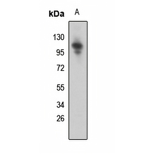 SNRP116 Rabbit Polyclonal Antibody
