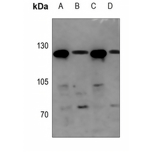 UBE4A Rabbit Polyclonal Antibody