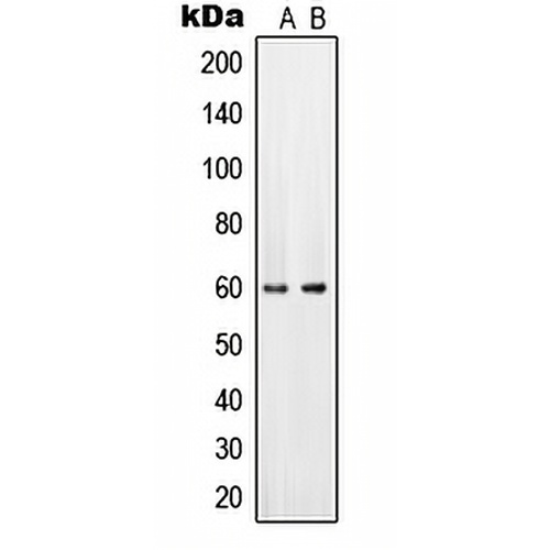 PAHT Rabbit Polyclonal Antibody