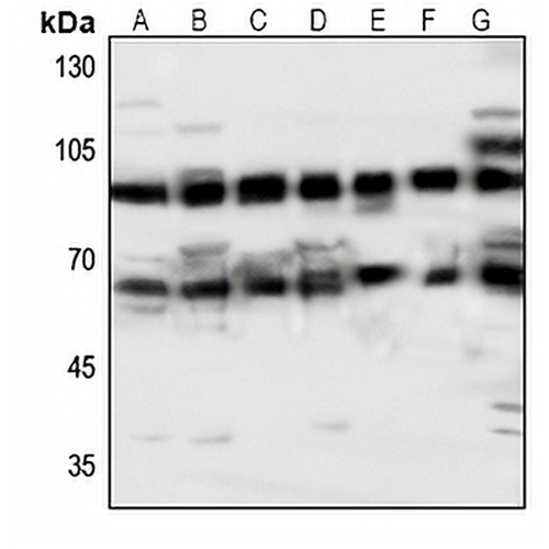 ABCG2 Rabbit Polyclonal Antibody