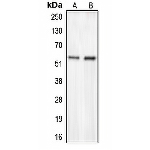 CHST2 Rabbit Polyclonal Antibody
