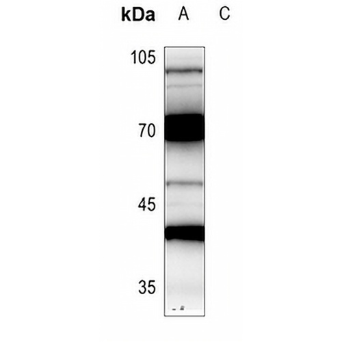 CRSP7 Rabbit Polyclonal Antibody