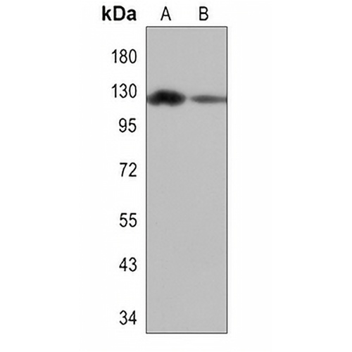 PERK Rabbit Polyclonal Antibody