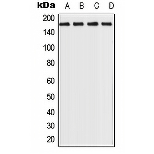 ROCK2 Rabbit Polyclonal Antibody