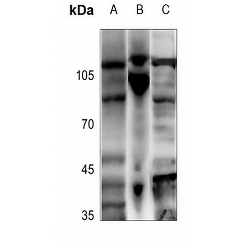ADAMTS2 Rabbit Polyclonal Antibody