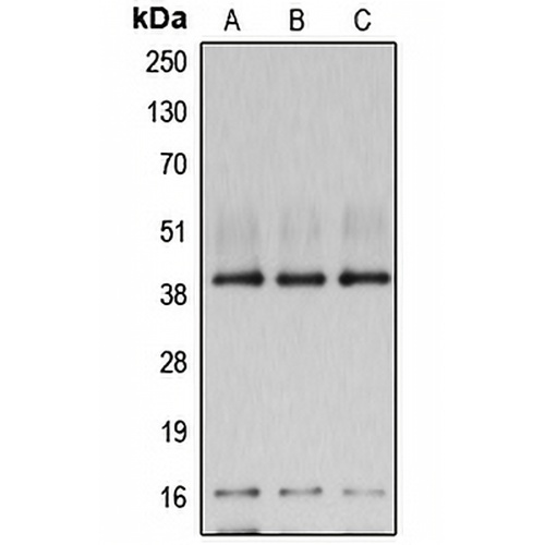 POLR1C Rabbit Polyclonal Antibody