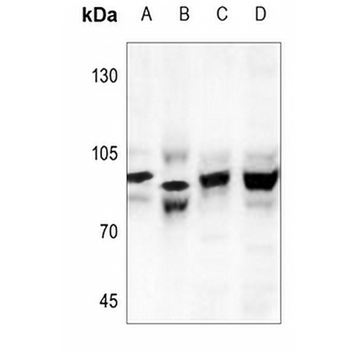CHD1L Rabbit Polyclonal Antibody