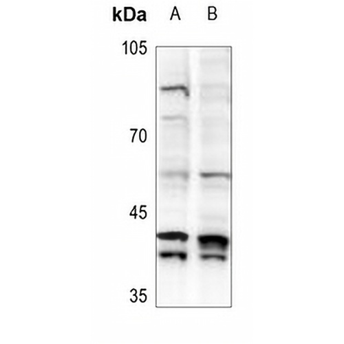 MAD2L1BP Rabbit Polyclonal Antibody