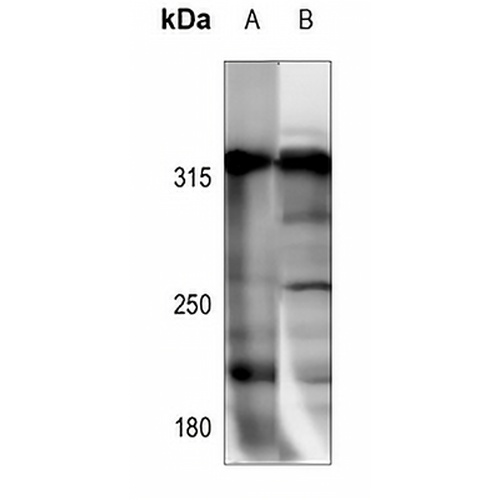 NCOR1 Rabbit Polyclonal Antibody