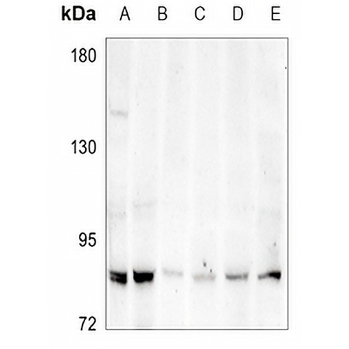 ABCG1 Rabbit Polyclonal Antibody