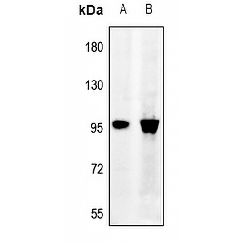 Synphilin 1 Rabbit Polyclonal Antibody