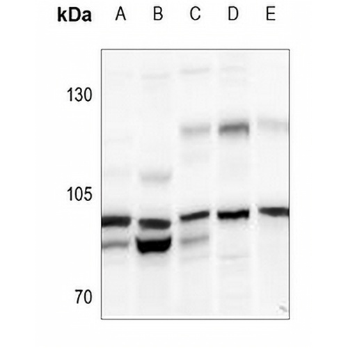 N4BP1 Rabbit Polyclonal Antibody