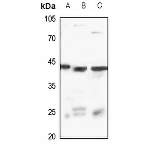 RASSF2 Rabbit Polyclonal Antibody