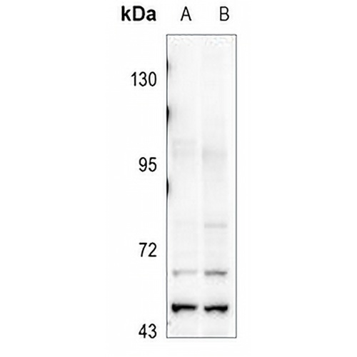 GFR Rabbit Polyclonal Antibody