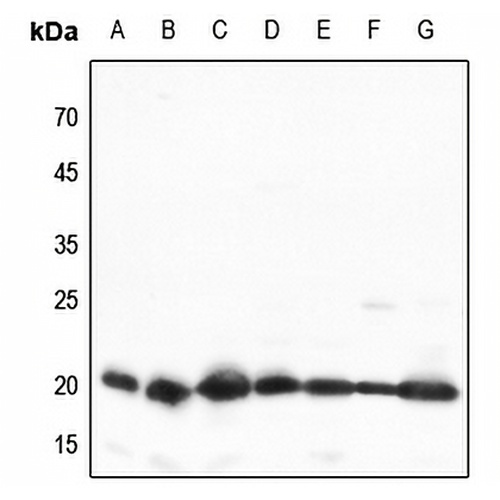 TOM20 Rabbit Polyclonal Antibody