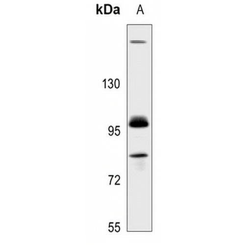GAB2 Rabbit Polyclonal Antibody
