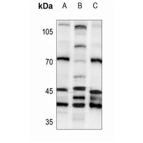 PSMD6 Rabbit Polyclonal Antibody