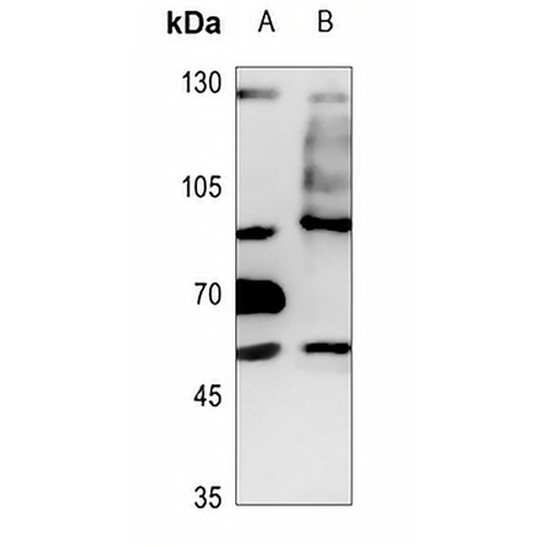 TLK1 Rabbit Polyclonal Antibody