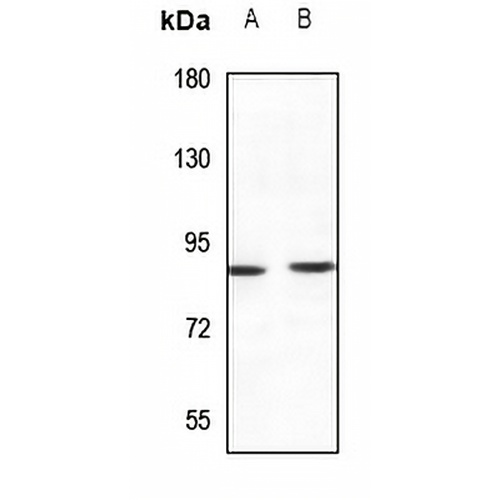 TLK1 Rabbit Polyclonal Antibody