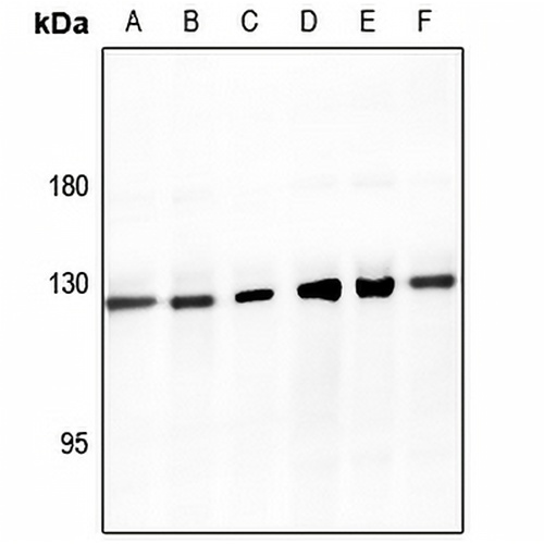 SMG7 Rabbit Polyclonal Antibody