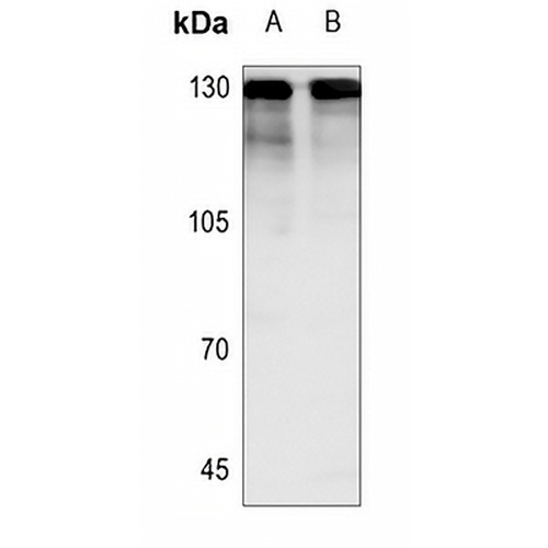 NICE4 Rabbit Polyclonal Antibody