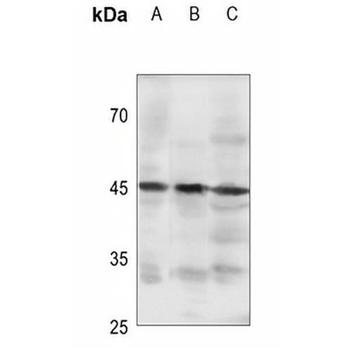 GPR105 Rabbit Polyclonal Antibody