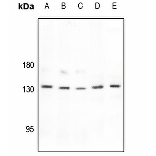 Histone Deacetylase 6 Rabbit Polyclonal Antibody