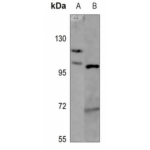 Histone Deacetylase 5 Rabbit Polyclonal Antibody