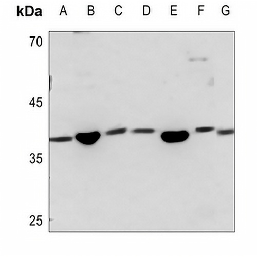 SAE1 Rabbit Polyclonal Antibody