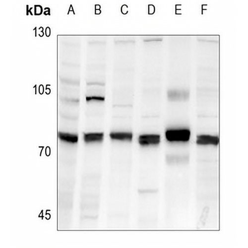 FARSB Rabbit Polyclonal Antibody