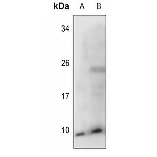 COX17 Rabbit Polyclonal Antibody