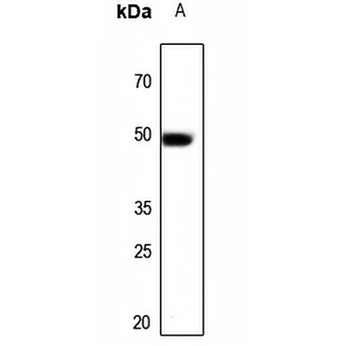 ARP3 Rabbit Polyclonal Antibody