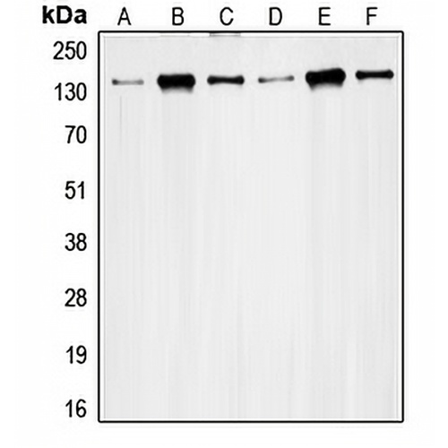 RAD50 Rabbit Polyclonal Antibody