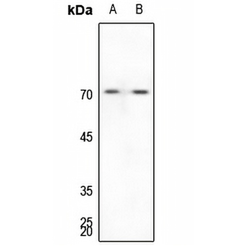 G3BP1 Rabbit Polyclonal Antibody