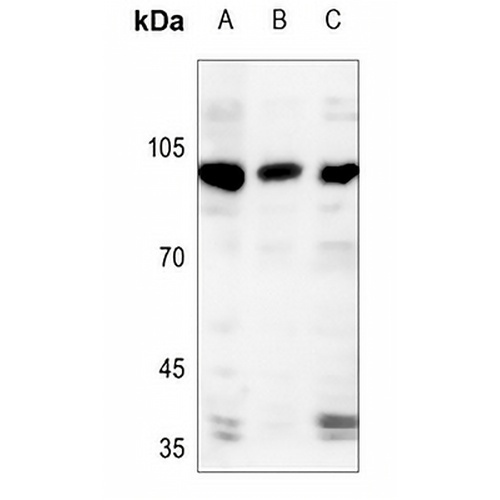 AASS Rabbit Polyclonal Antibody
