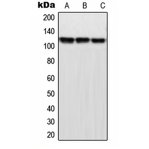 MPP9 Rabbit Polyclonal Antibody