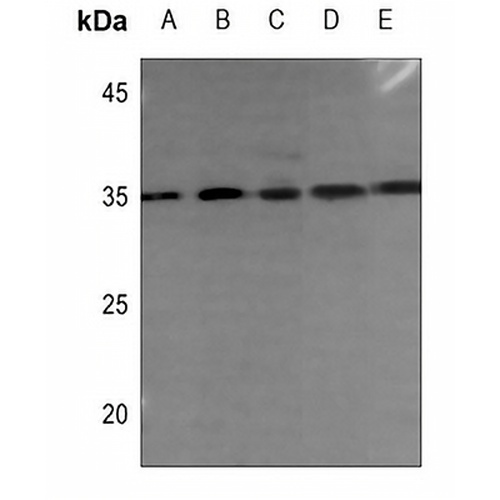 DHRS2 Rabbit Polyclonal Antibody