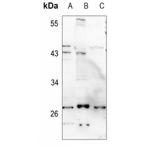 KCNMB2 Rabbit Polyclonal Antibody