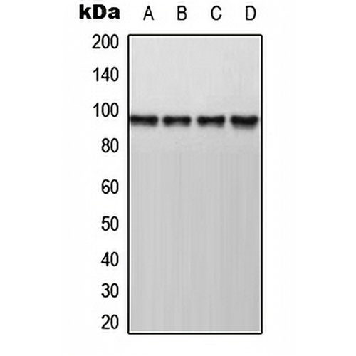 AKAP8 Rabbit Polyclonal Antibody