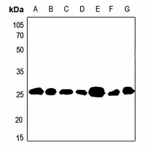 BCAS2 Rabbit Polyclonal Antibody