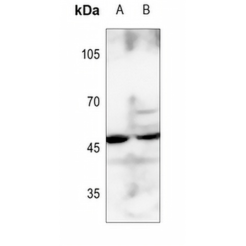 BCKDK Rabbit Polyclonal Antibody