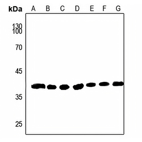 AKR1A1 Rabbit Polyclonal Antibody